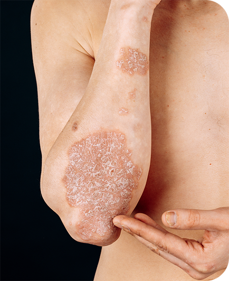 Ellenbogen-rund-komp