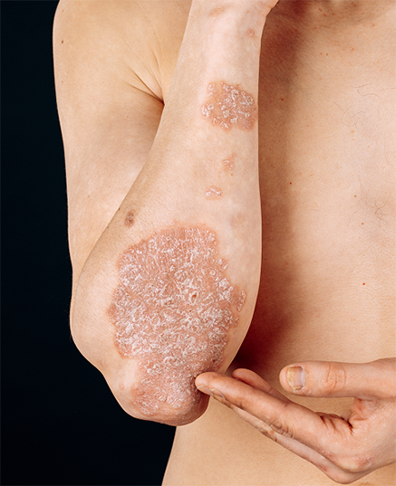 Ellenbogen-rund-komp